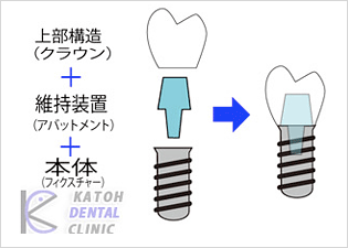 Cvg(tBNX`[)